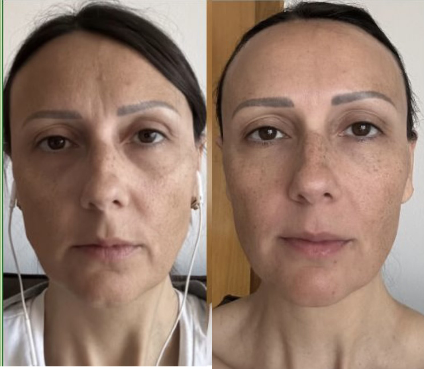 Mercedes, 44